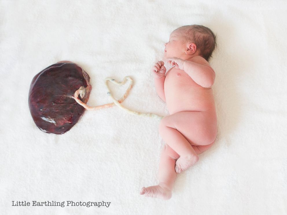 placenta