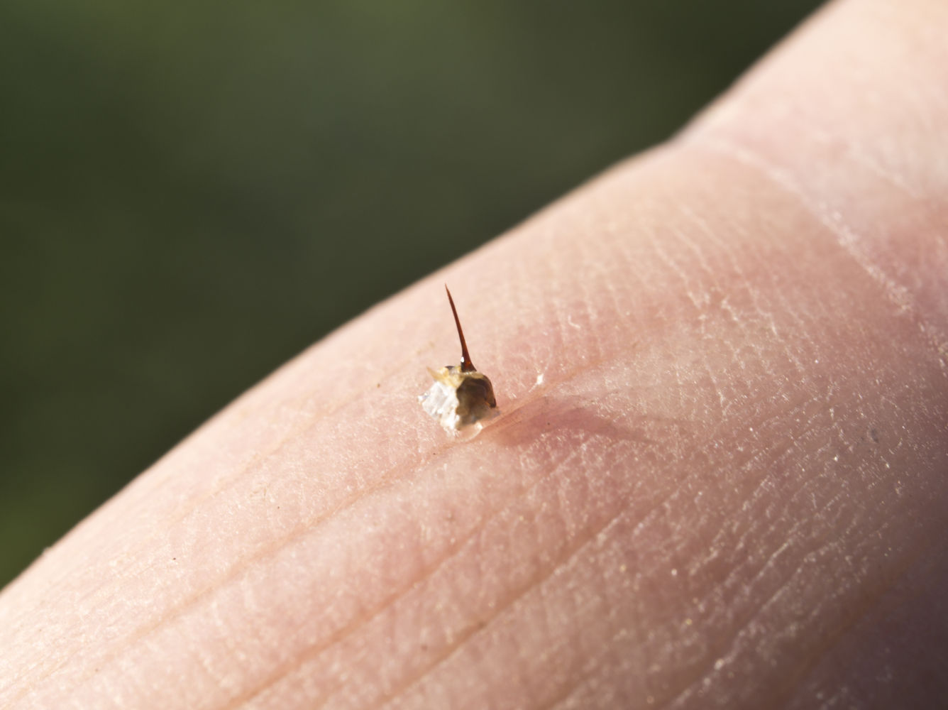 Bee Sting – a weapon of defense and attack.